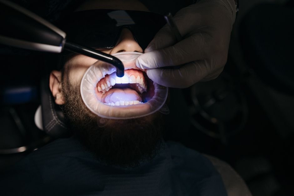 Chipped Tooth: Why You Shouldn't Ignore It